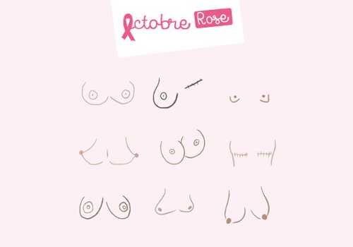 Octobre Rose : le Pays Mornantais se mobilise